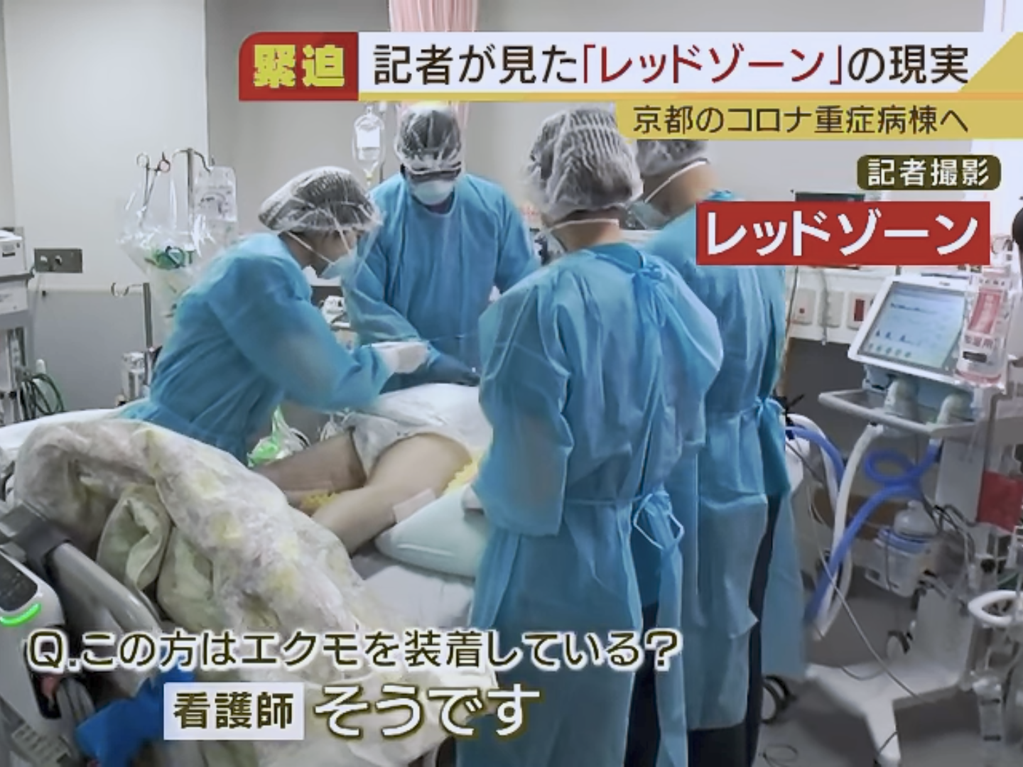 「サイレントパンデミック」薬の効かない薬剤耐性菌が静かに拡大中　2050年にはがん死者を超える恐れ