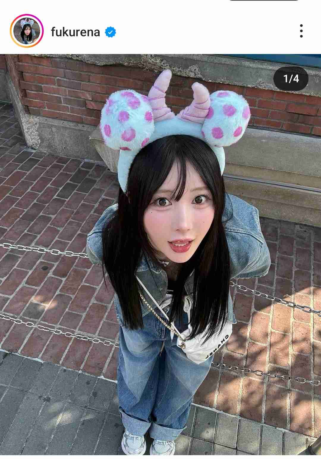 いくら整形しても「顔がデカい」と言われ…整形アカウント“炎上”の真相を本人に聞いた