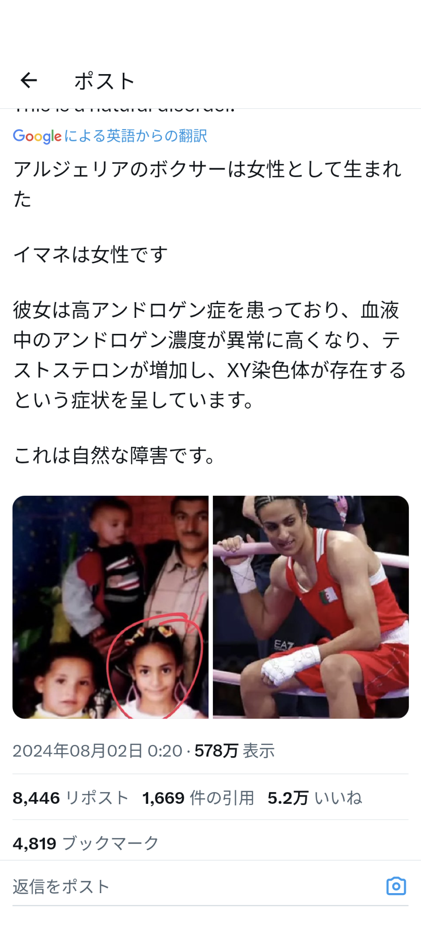 性別騒動の女子ボクサーをめぐりIOCが声明「すべての人は差別なくスポーツをする権利を持っている」出場の正当性強調　パリ五輪２回戦で強打浴びた相手が号泣棄権