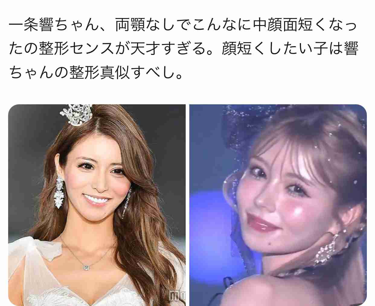 元歌舞伎町No.1キャバ嬢・愛沢えみり（35）、整形箇所の修正を報告＆ビフォアフ公開 「土台は思い切って課金する」