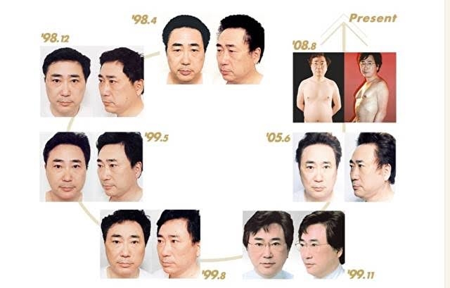 高須幹弥院長が美容整形業界の闇を告発「二重まぶた手術で50万円」「ボッタクリ」