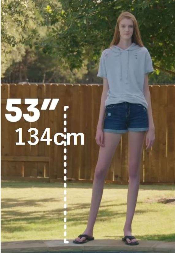 「長さ134cm」“脚が長すぎる” 女性が話題に…奇跡のスタイルをもつからこその悩みとは?
