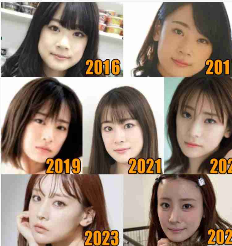 “顔の全パーツ整形済み”の福岡みなみ「すればするほど変な顔になる」　美容整形について率直な心境を告白