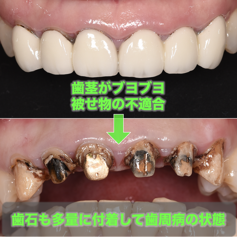 【恋愛】恋人にするなら「歯並びが悪い人」or「口臭が気になる人」どっち？　男女300人の“選択”がリアルだった