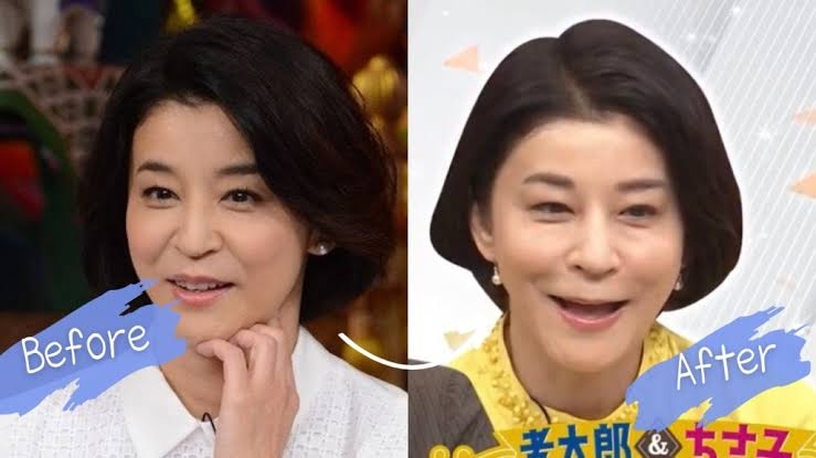 高嶋ちさ子、韓国での美容施術に失敗！医師が教える「かかってはいけない美容医療」美容クリニックには怪しい所も