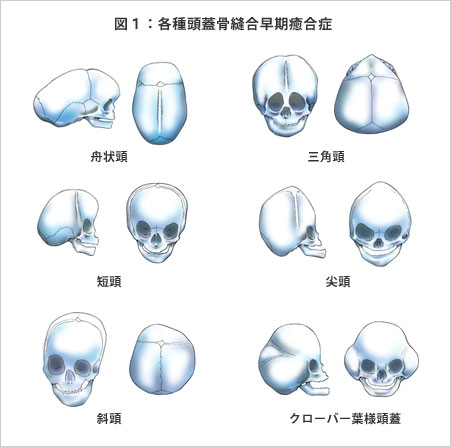 頭が小さいのがコンプレックス