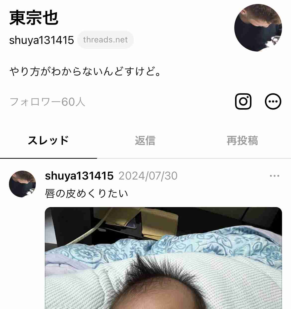赤ちゃん意識不明の重体 口の中に「おしり拭き」入れて殺そうとした疑いで男逮捕