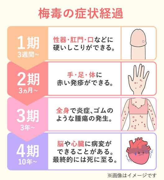 東京の梅毒感染者2400人超で過去最多ペースで増加…内訳は男性7割女性3割　無料・匿名の検査相談室を新宿や多摩地域に設置