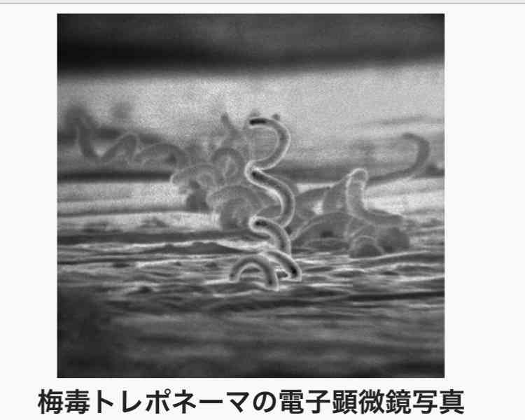 東京の梅毒感染者2400人超で過去最多ペースで増加…内訳は男性7割女性3割　無料・匿名の検査相談室を新宿や多摩地域に設置