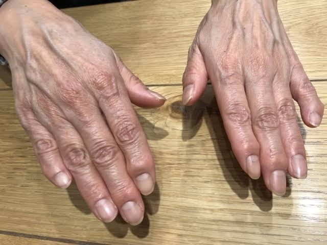 ついに来た!と思った老化現象