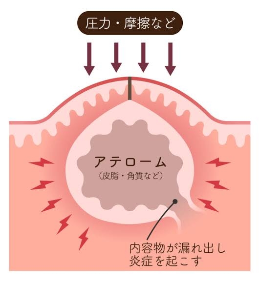 今日やったことにプラス