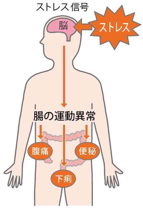 過敏性腸症候群を治したい！