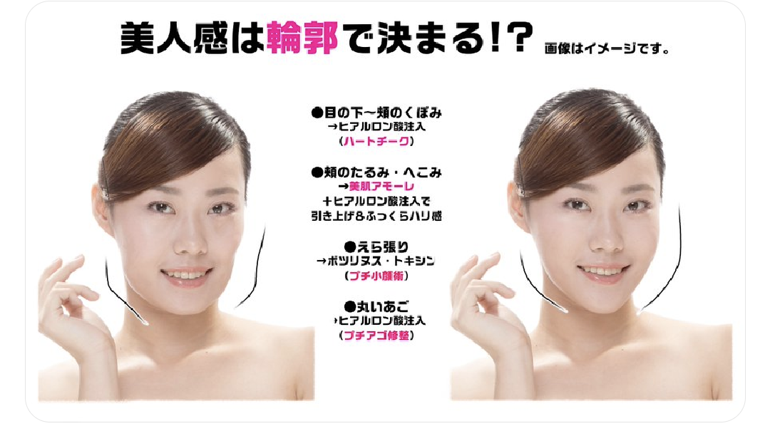リフトアップに良いもの教えて