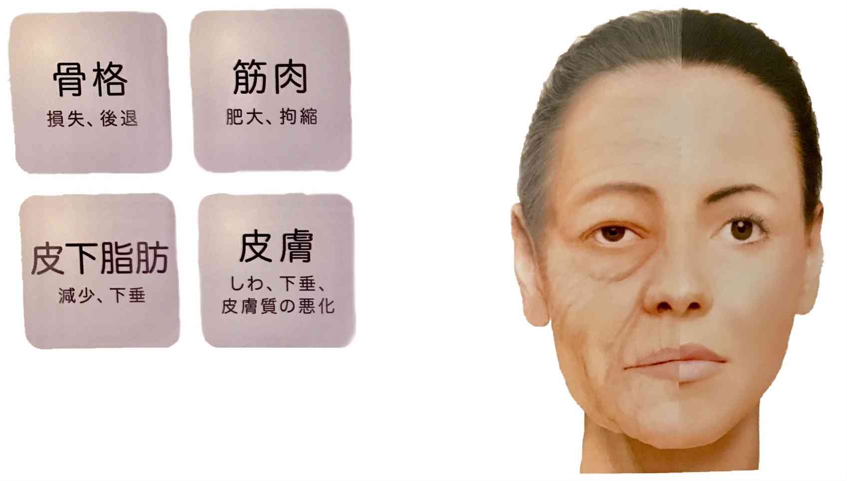 【謎】年を取ると鼻が巨大化する現象【何故？】