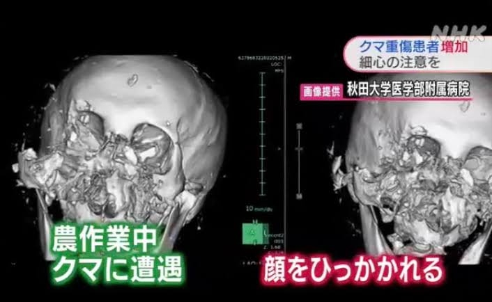 秋田県知事、クマ駆除への苦情に「お付き合いする必要ない」…「お前のところにクマを送ると威嚇する」