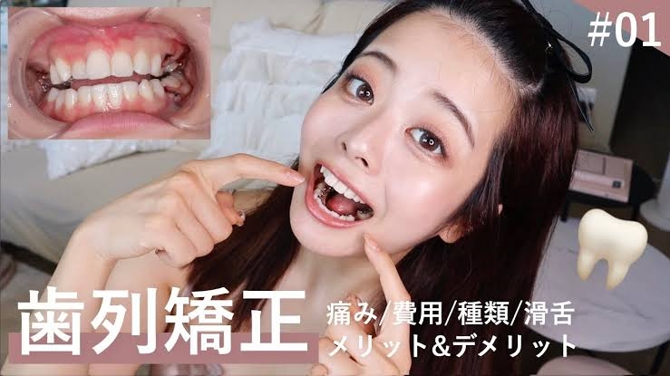 裏側矯正した・してる人【歯列矯正】