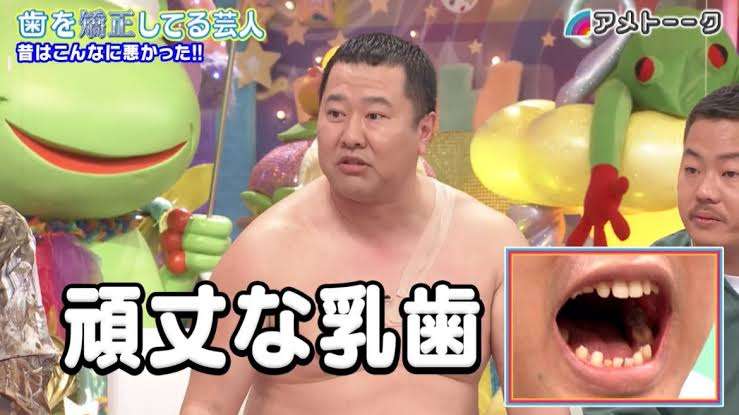 大人だけど乳歯ある人