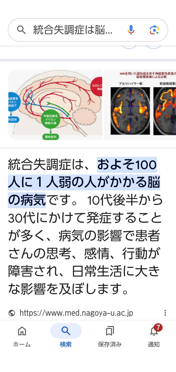 100人に1人が統合失調症に　妄想や幻覚…10～30代で多く発症
