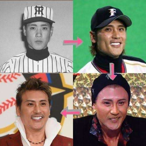 新庄監督が仰天告白! 「シーズン終わって、すぐ目の整形して…」同部屋にいた芸能人は驚きの表情