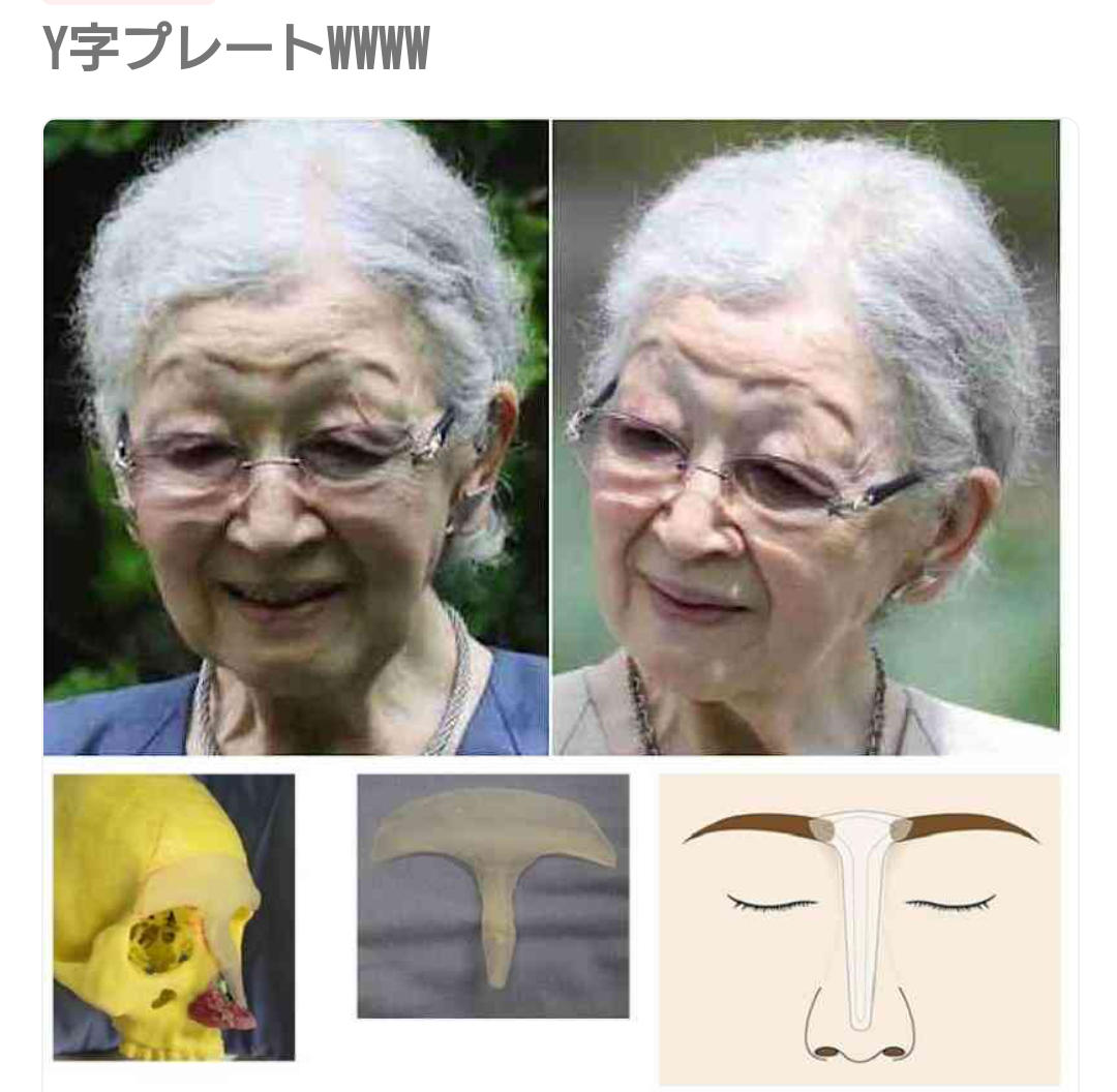 https://up.gc-img.net/post_img/2025/01/OqFvHKFMzAWoFim_B4Hjy_3327.png
