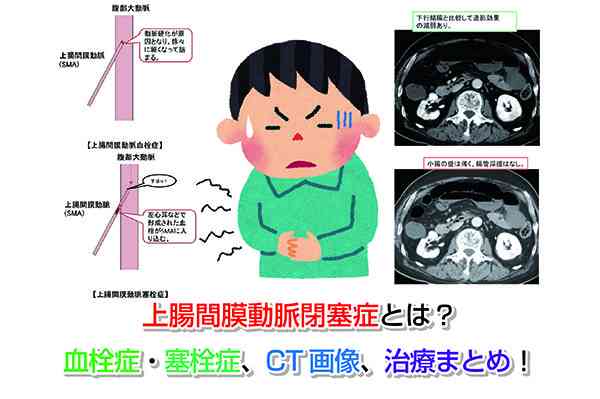あまり知られていないけど、怖い病気