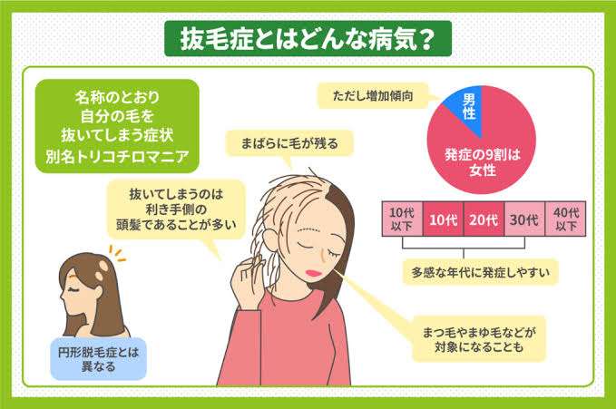 抜毛症