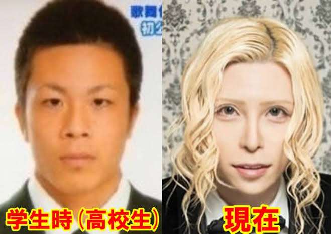 恋人が整形していた
