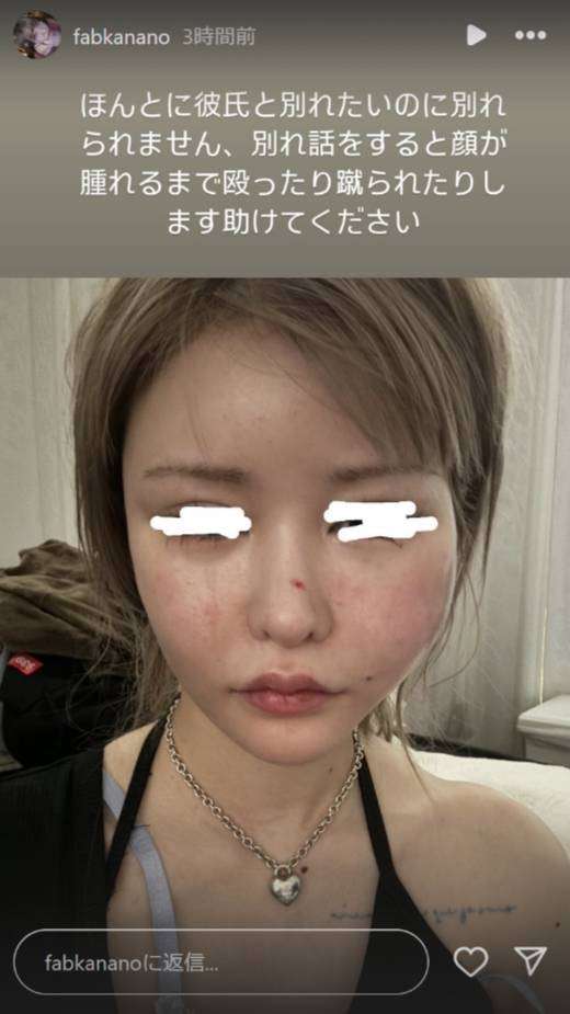 戦慄かなの、DJまるとの交際継続を明言「いっぱい償ってくれたから許したよ」