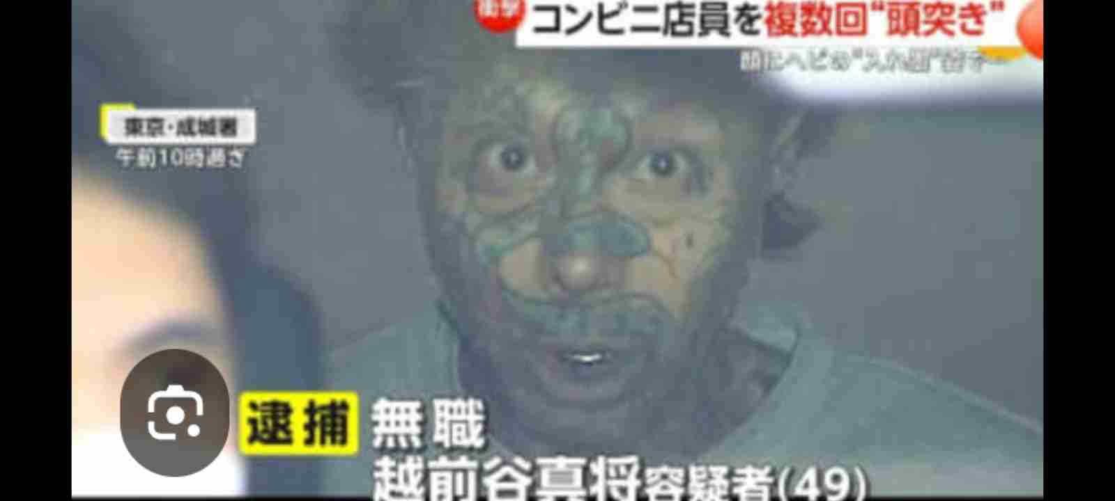 【閲覧注意】“爬虫類顔”になりたい青年、手術を繰り返して頭に角、眼球も黒く染めて…店や銀行で入店拒否