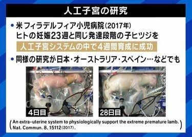 都内の出産女性、64％が「無痛分娩」希望…うち4割超は高額費用など理由に実際は選択せず