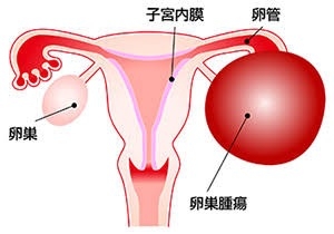 腹腔鏡手術経験者の方