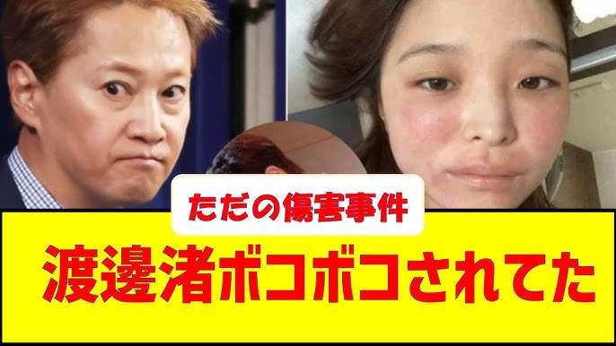 浜田雅功のレギュラー番組〝一部終了〟を検討　松本人志との活動再開を見据え整理か