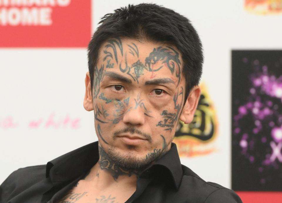タトゥー・刺青除去専門医が明かす患者の十人十色なワケアリ事情…「推し変したので消したい」「憎い人間を足裏に入れて毎日踏んだけど…」