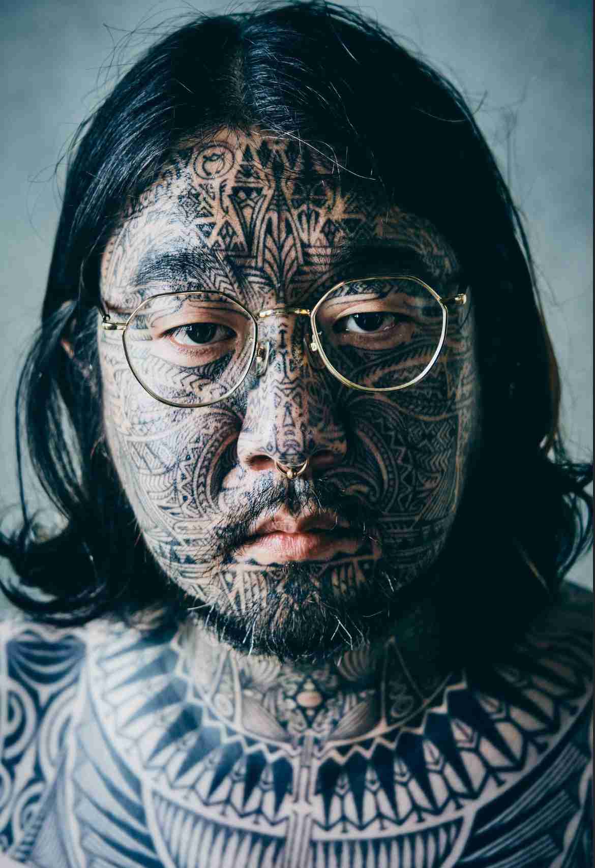 タトゥー・刺青除去専門医が明かす患者の十人十色なワケアリ事情…「推し変したので消したい」「憎い人間を足裏に入れて毎日踏んだけど…」