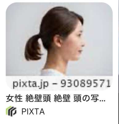 「赤ちゃんの頭の形が気になる」 ヘルメットで矯正の外来に受診者急増　生後6か月までに始めると効果的　広島大学病院
