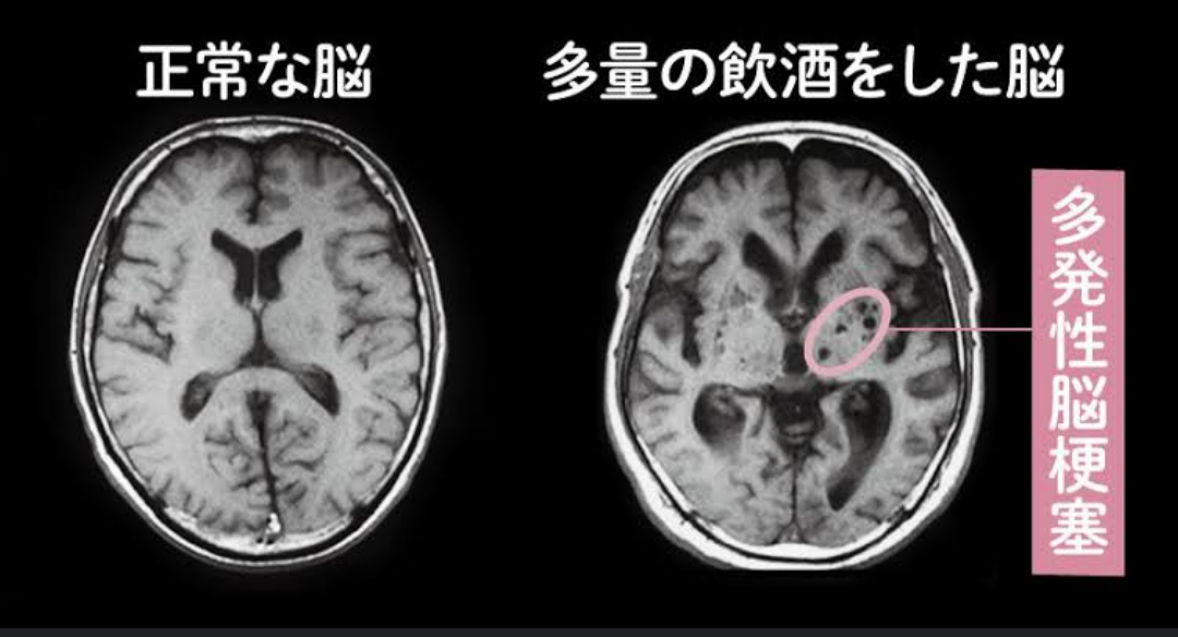 お酒で何とか毎日乗り切ってる人～