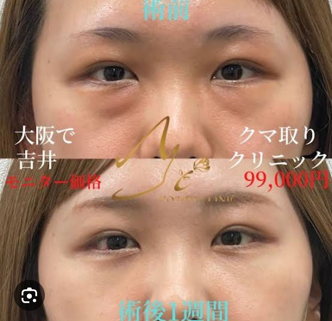 旦那に内緒で美容整形したい