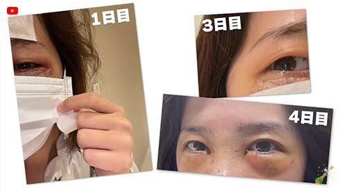 旦那に内緒で美容整形したい