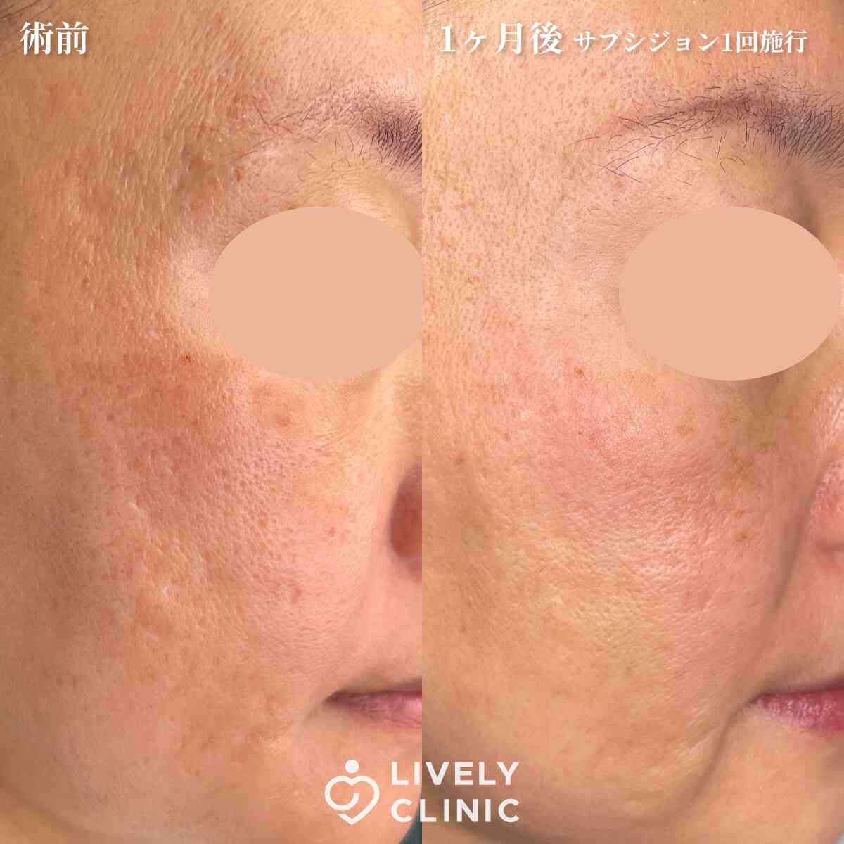 美容医療総合【雑談トピ】