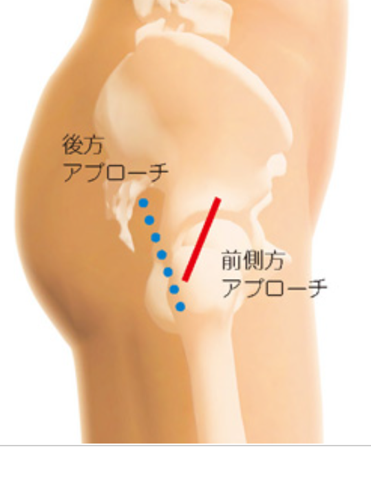 放置している身体の不調