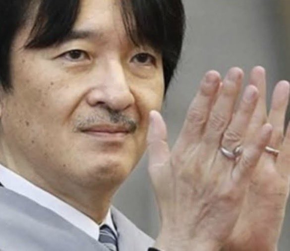 比較されがちなこと