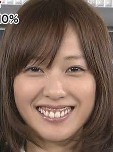 戸田恵梨香：ベリーショートに大胆イメチェン後初表紙　「美的」に登場　メークや私服にも「いろいろな変化」と語る