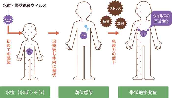 立川志らく、ついに歩行不能に　病名を推察「多分…MRI検査する」