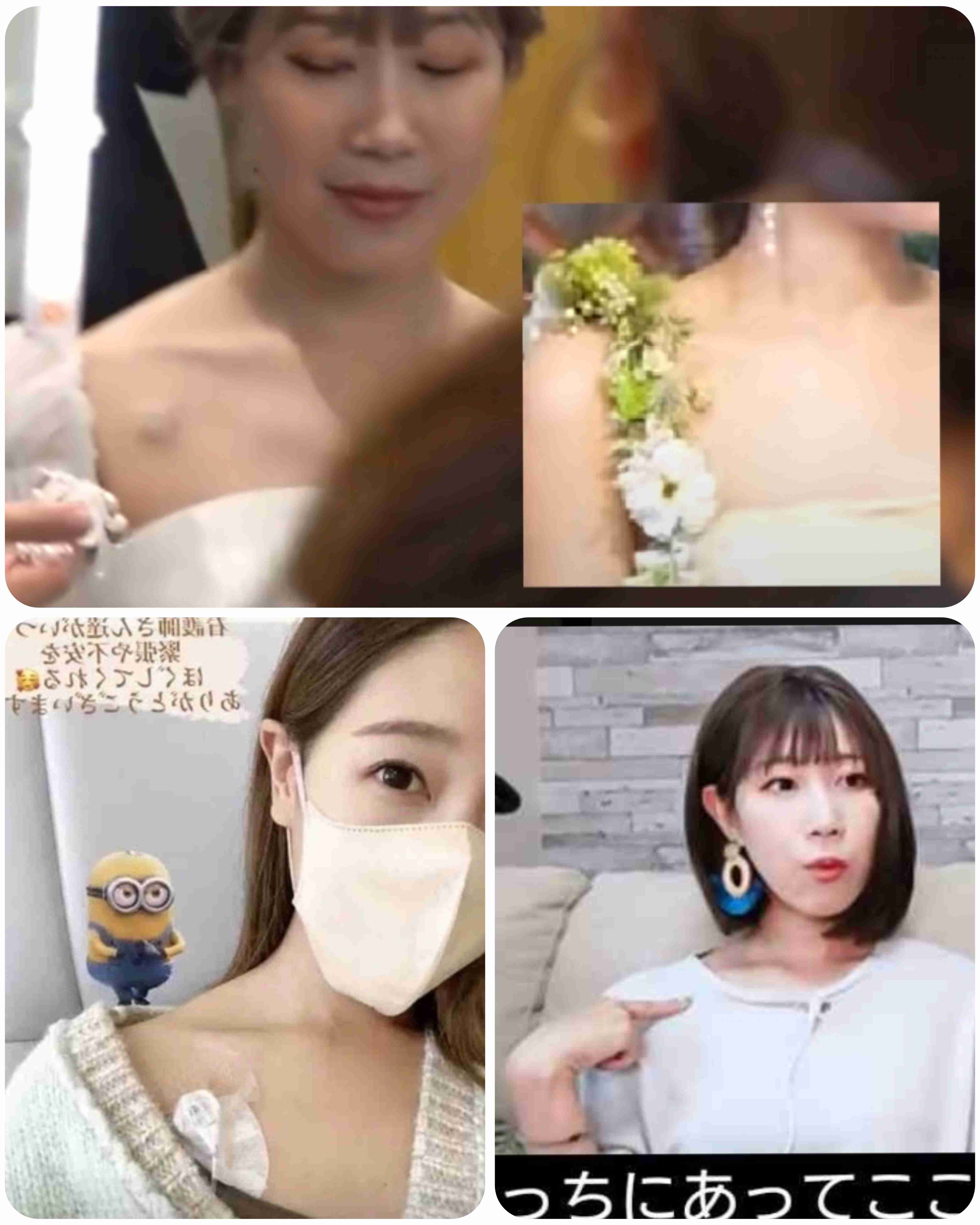 すい臓がん公表ユーチューバー　がんの肺転移を報告　夫は悲痛「考えられる限り最悪の形だった」