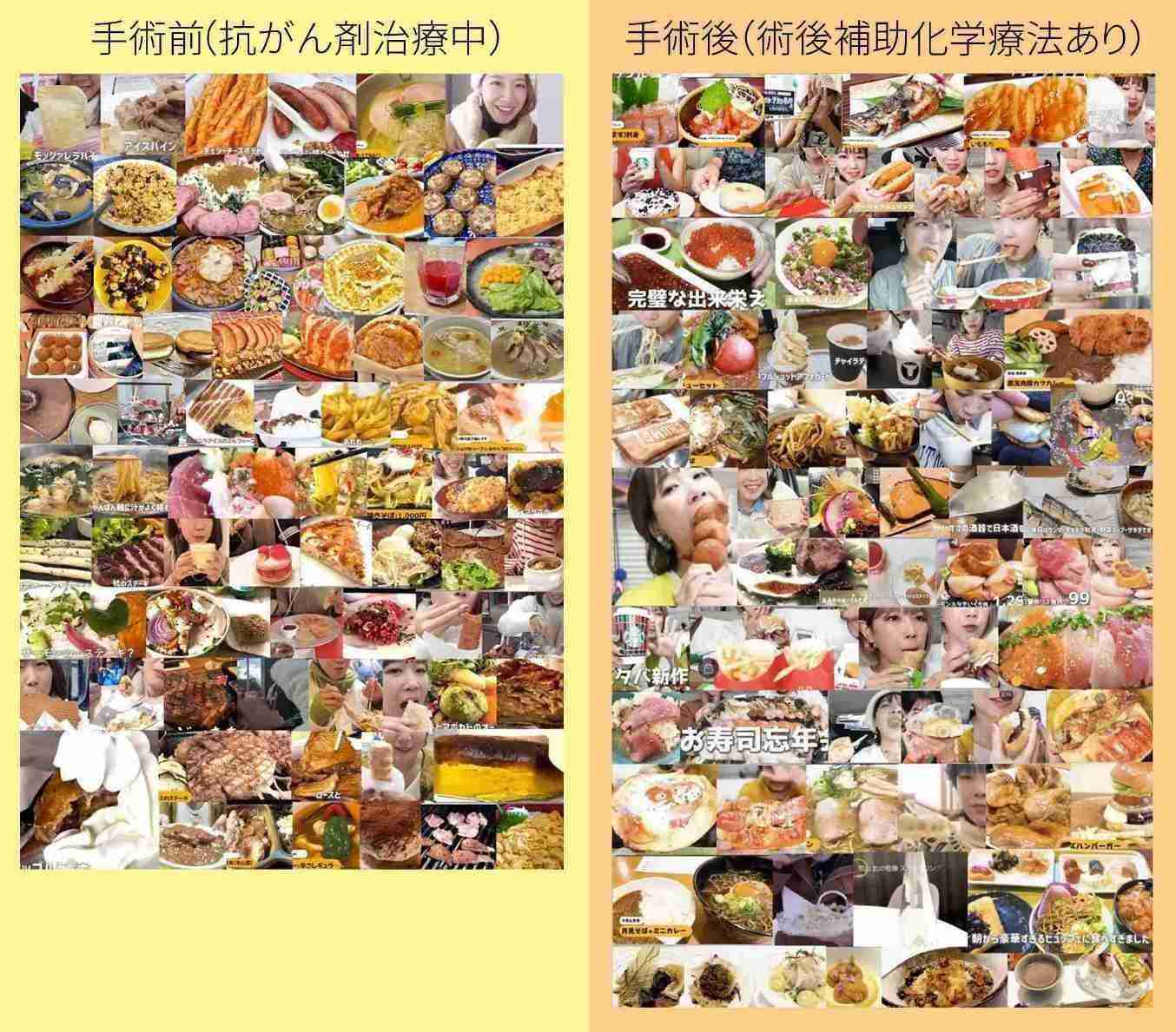 すい臓がん公表ユーチューバー　がんの肺転移を報告　夫は悲痛「考えられる限り最悪の形だった」