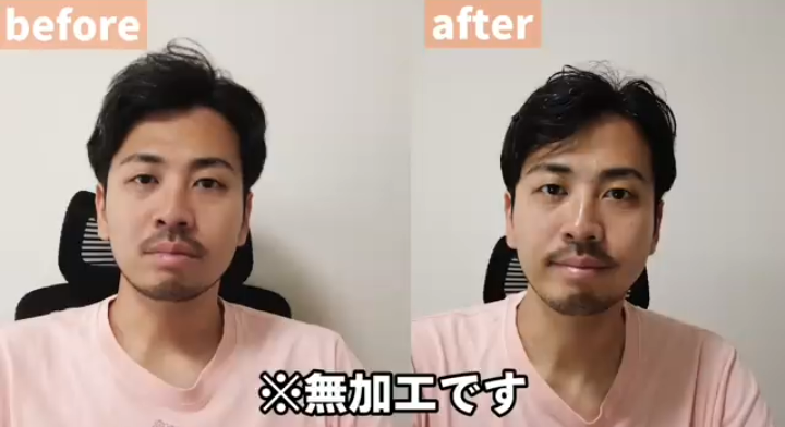 すい臓がん公表ユーチューバー　がんの肺転移を報告　夫は悲痛「考えられる限り最悪の形だった」