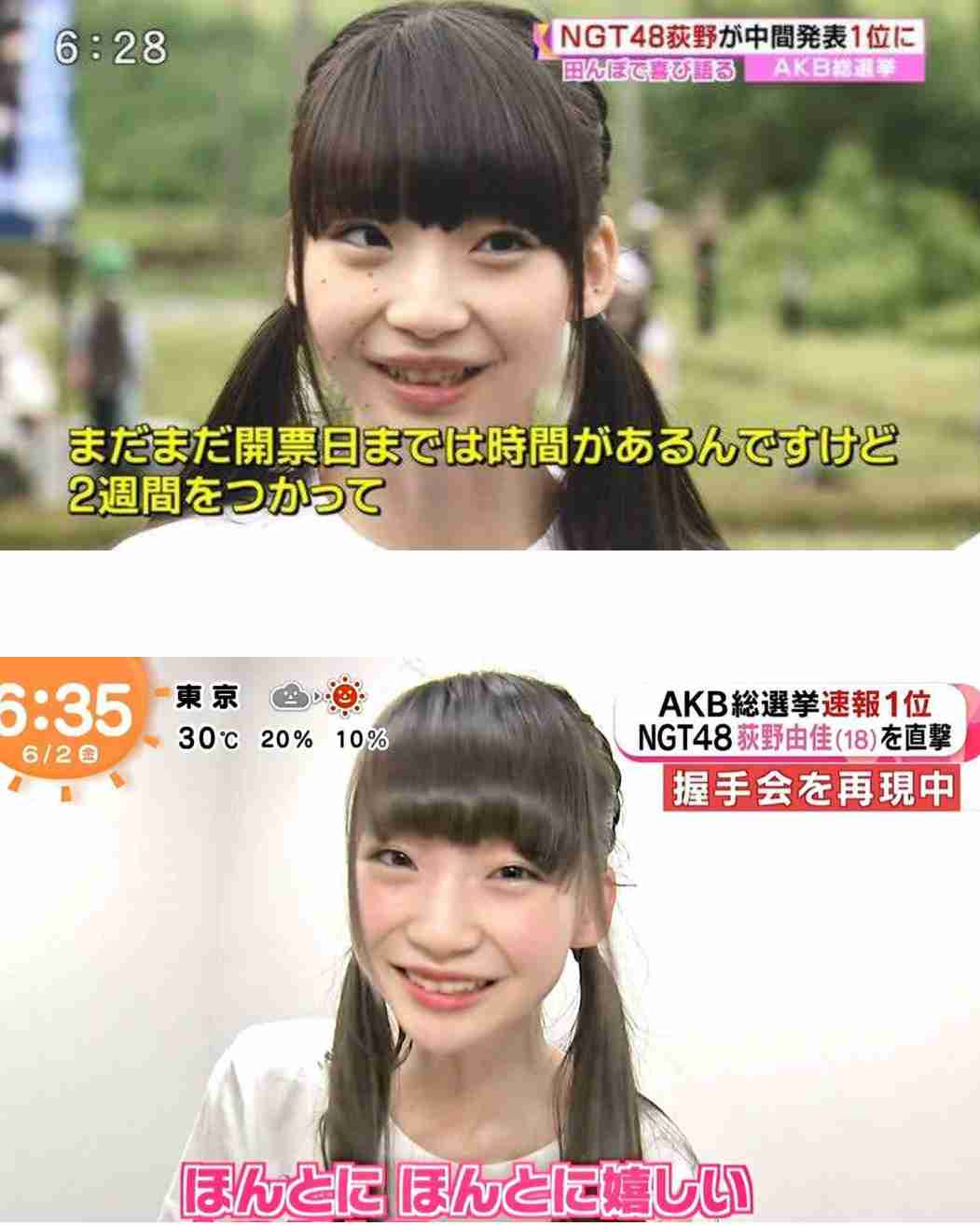 元NGT48メンバーが整形箇所と総額を赤裸々告白「高かったんですけど、早めに可愛くなってうれしい」