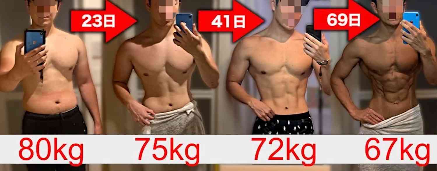 元NGT48メンバーが整形箇所と総額を赤裸々告白「高かったんですけど、早めに可愛くなってうれしい」