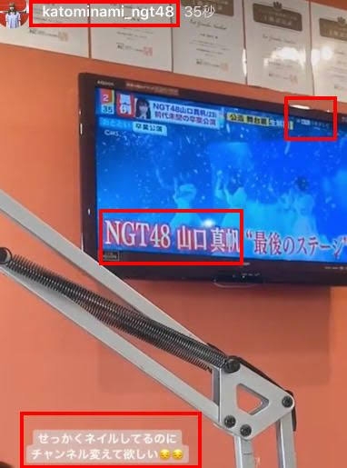 元NGT48メンバーが整形箇所と総額を赤裸々告白「高かったんですけど、早めに可愛くなってうれしい」