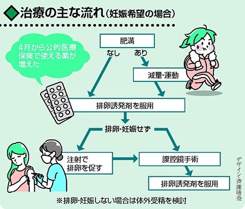 不妊治療と仕事の両立について